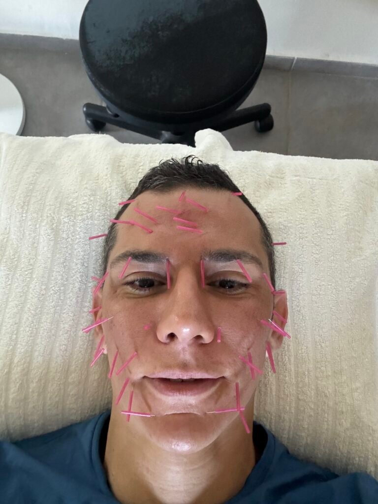 תמונה מטיפול בקליניקת TerraP